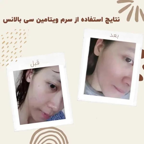 سرم ویتامین سی بالانس - Image 4
