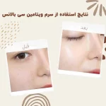 سرم ویتامین سی بالانس - Image 5