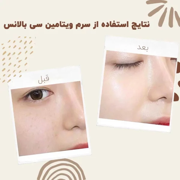 سرم ویتامین سی بالانس - Image 5