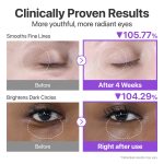 کرم دور چشم NAD و رتینول +9 نامبوزین حجم 10 میل - Image 2
