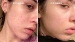 سرم ضد لک نیاسینامید آنوا حجم 30 میل - Image 3